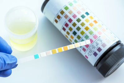 GDT-Schnittstelle für die Analyticon Biotechnologies AG
